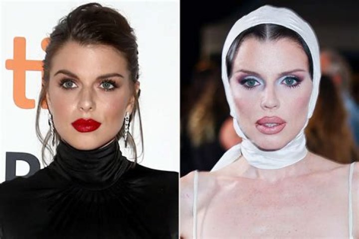 Unraveling Nicole Shanahan's Plastic Surgery Journey